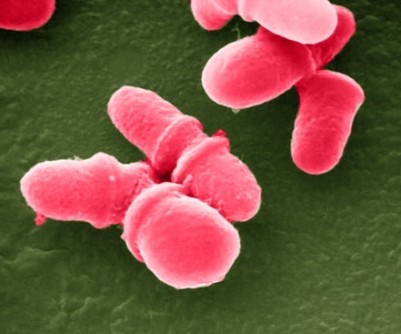 Newswise: Gut microbes may lead to therapies for mental illness, UTSW researcher reports