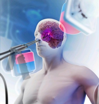 Newswise: Tiny surgical robots could transform detection and treatment of cancers