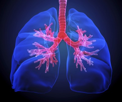 Newswise: Unique Cell-Based Approach for Pulmonary Arterial Hypertension Shown to Be Safe