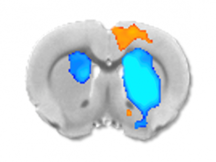 Newswise: A New Study Shows How Neurochemicals Affect fMRI Readings