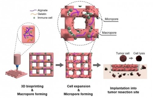 Newswise: 3D bioprinting technology to be used for removing cancer cells